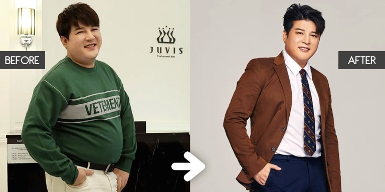 Super Junior Shindong kiloları öncesi sonrasın Sonraki Halini Paylaştı